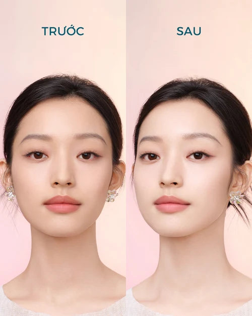 Bộ Nét Ngọc Rạng Rỡ