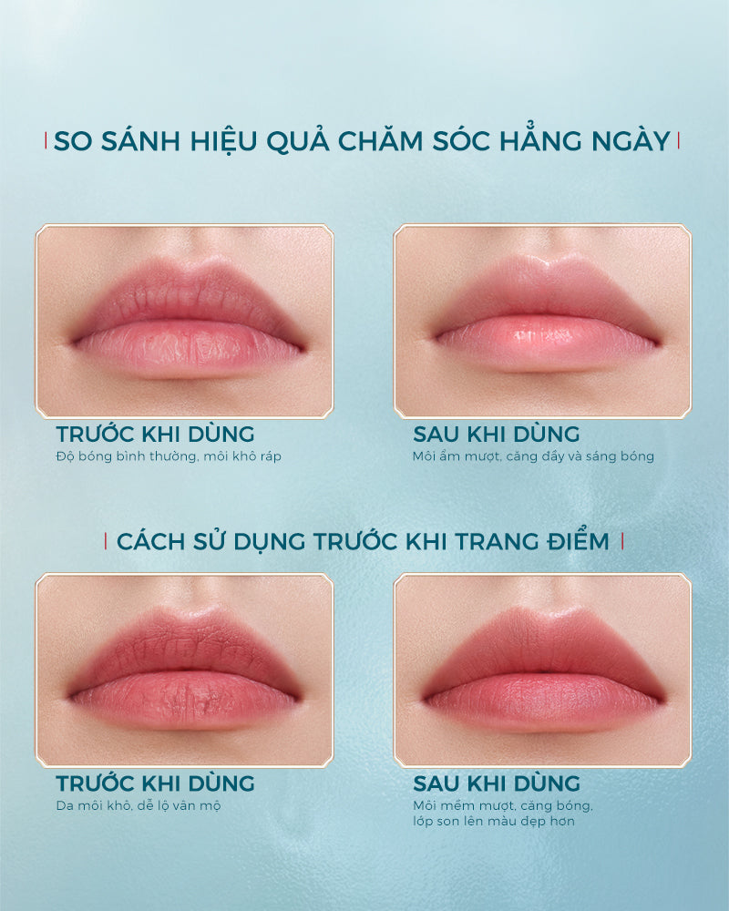 Mặt Nạ Dưỡng Môi Hoa Nhuận Sâm 6g - Bao Bì Mới